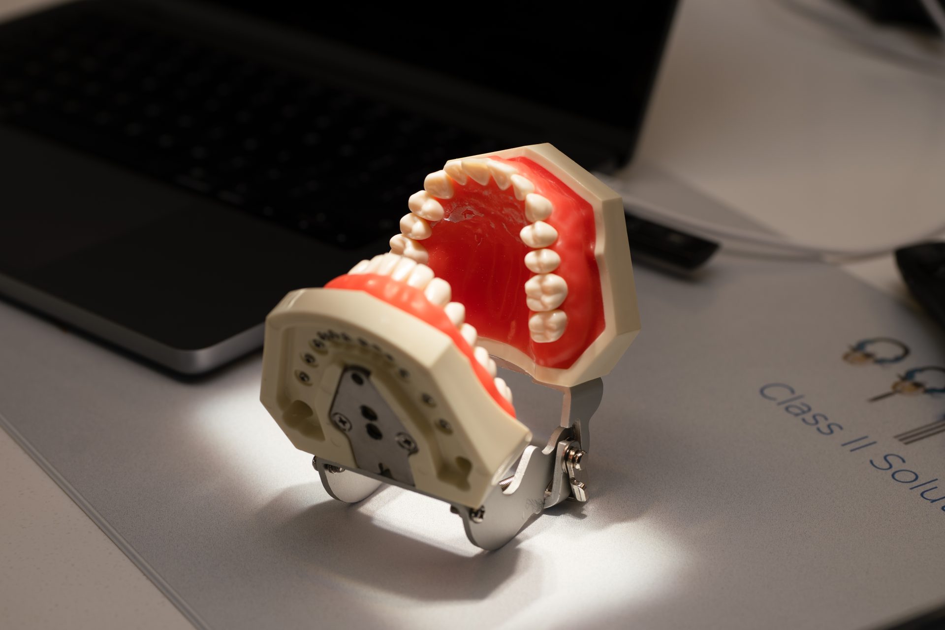 5 Easy Steps for Frontal Restorations